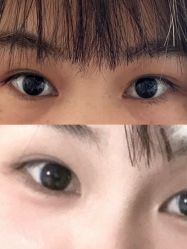 -丰联丽格医疗美容·联合丽格眼整形中心