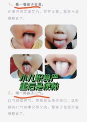 -神拿世家小儿推拿(立水桥店)