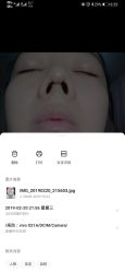 点击看大图 -成都艾特他整形外科医院