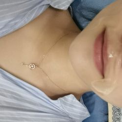 体验前-泉州欧菲医疗美容