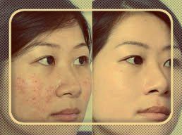 -SKINIST丽铂医疗美容