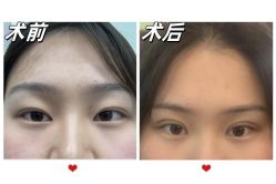 -素美医疗美容·西南眼鼻整形·修复基地