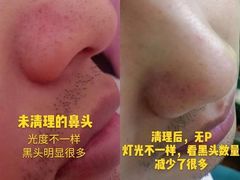 -艾通康缘艾灸.疼痛.睡眠养生馆(凤凰城店)