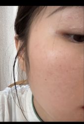 -成都西区医院整形美容