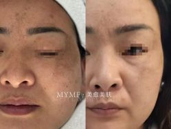 -美愈美肤MEIYU SKIN