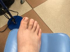 -世龙世家灰指甲鸡眼脚气甲沟炎跖疣护理(通州店)