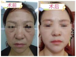 -素美医疗美容·西南眼鼻整形·修复基地