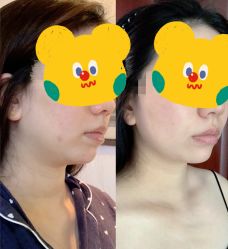 -深圳春天阳光医院·轮廓抗衰中心