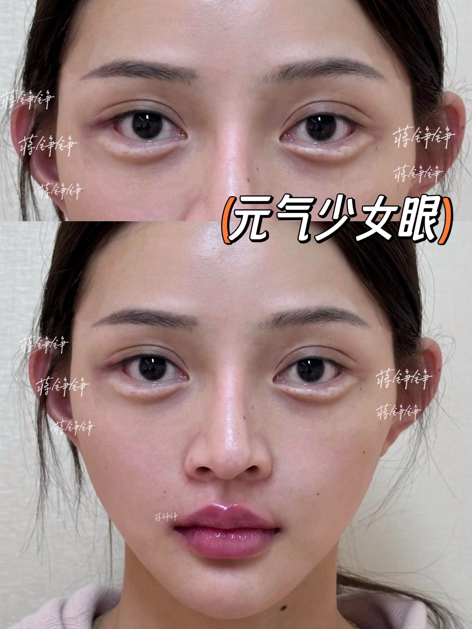 30分钟get💕元气少女眼❗