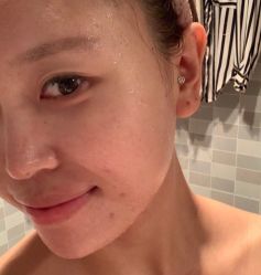体验后-坤如玛丽·医疗美容中心