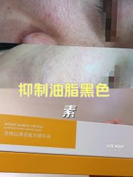 点击看大图 -SKIN79皮肤管理中心