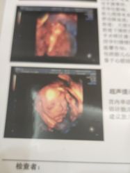 -艾博尔医院