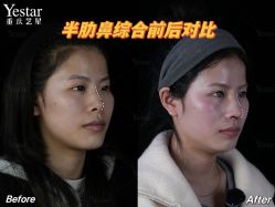 -Yestar重庆艺星医疗美容医院