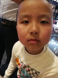 -咪咪专业脱毛连锁机构