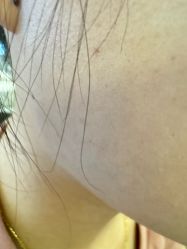 -美瑞莎创美医疗美容