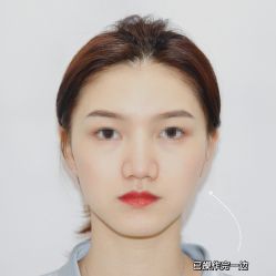 -丽美妍医疗美容·皮秒·立体分层抗衰