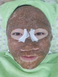 -苗医生专业祛痘全国连锁