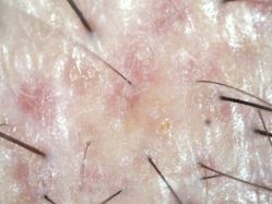 -雍禾植发全国连锁