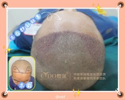 -熙朵美学植发·连锁品牌