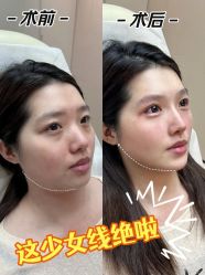 -深圳艺星医疗美容医院