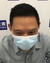 点击看大图 -大麦微针植发全国连锁