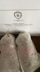 -肥三针腧穴瘦身馆