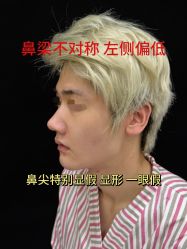 -北京米扬丽格医疗美容·联合丽格鼻整形中心