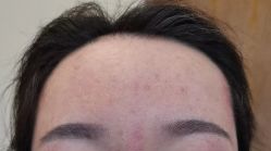 体验后-北京米扬丽格医疗美容·联合丽格鼻整形中心