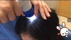 -大麦微针植发丨全国连锁