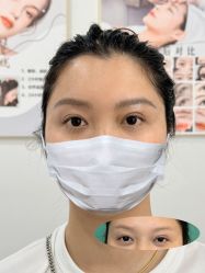 -杨益美学·野生眉半永久纹眉发际线