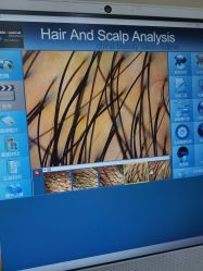 -熙朵美学植发·连锁品牌