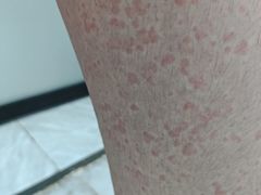 -广西壮族自治区南溪山医院