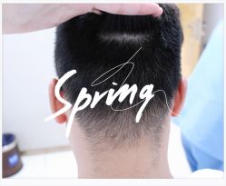 点击看大图 体验后-大麦微针植发全国连锁