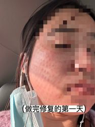 -海涛医疗美容·面部抗衰·注射美鼻