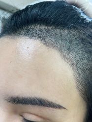 -熙朵美学植发·连锁品牌