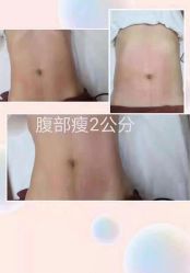 -Lily纤美·科技减脂中心