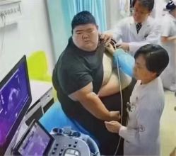 -香薇妮丝女子减肥院