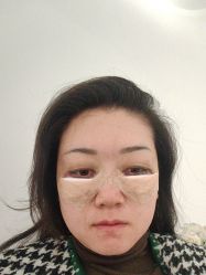 体验后-Dr.U博士医疗美容医院
