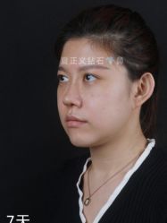 -北京米扬丽格医疗美容·联合丽格鼻整形中心