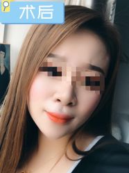 -素美医疗美容·西南眼鼻整形·修复基地