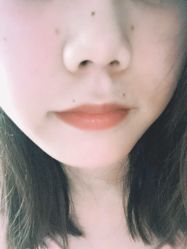 -斐研美医疗美容·眼周抗衰中心