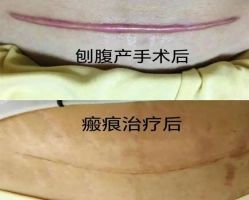 -北京妇产医院(东院)