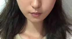 点击看大图 -广州美莱医疗美容医院