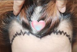 -大麦微针植发全国连锁