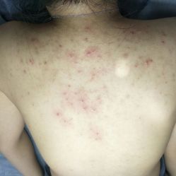 -莱可美科技美肤