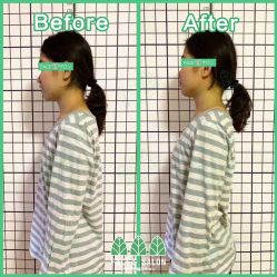 -FACE·日本小颜矫正美容整骨サロン