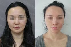-加减美医美连锁品牌