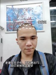 -雍禾植发全国连锁