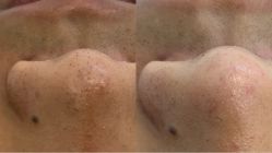 点击看大图 -蕾特恩专业祛痘·皮肤管理