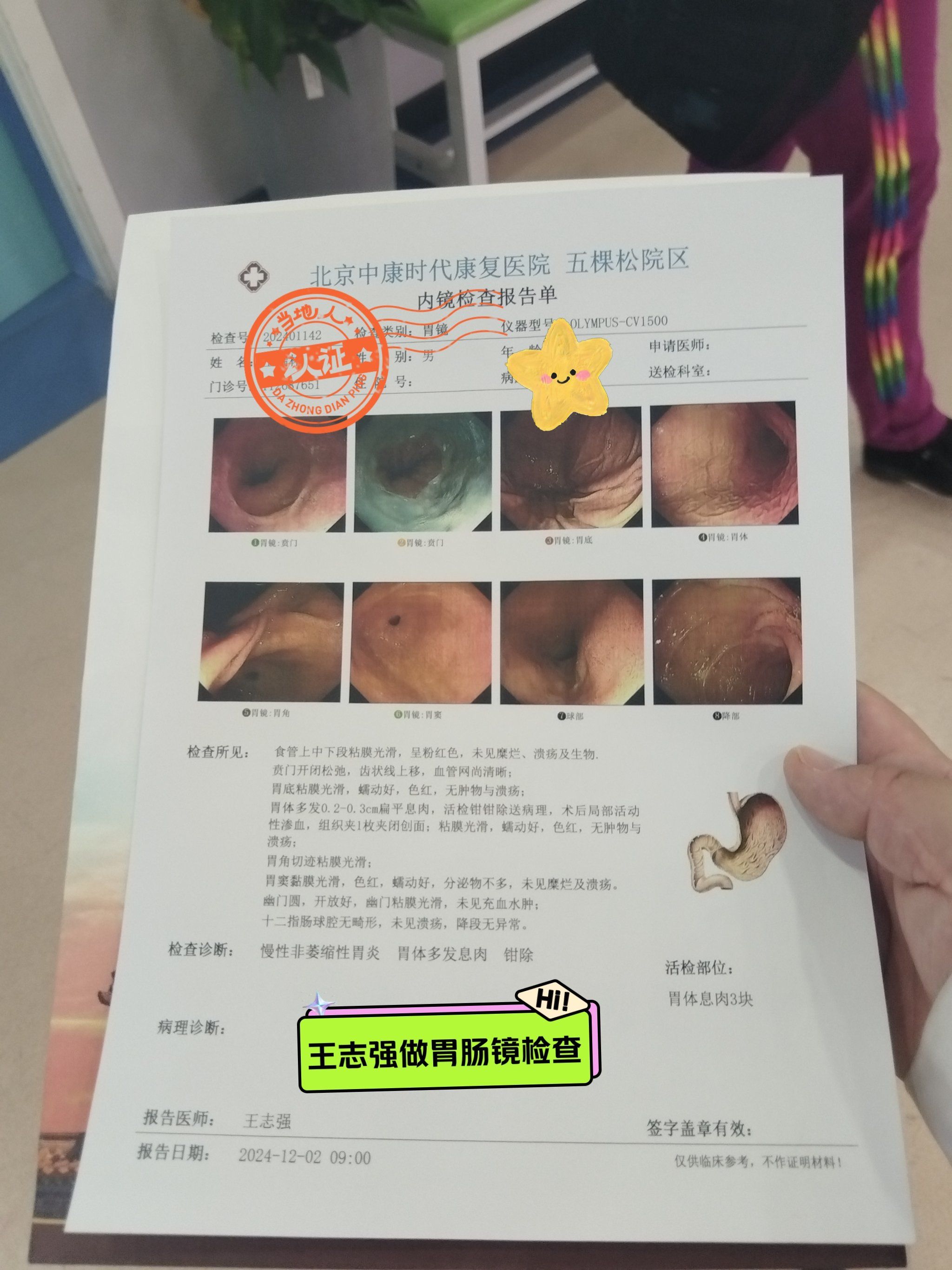北京301医院消化内科王志强主任亲自做胃肠镜